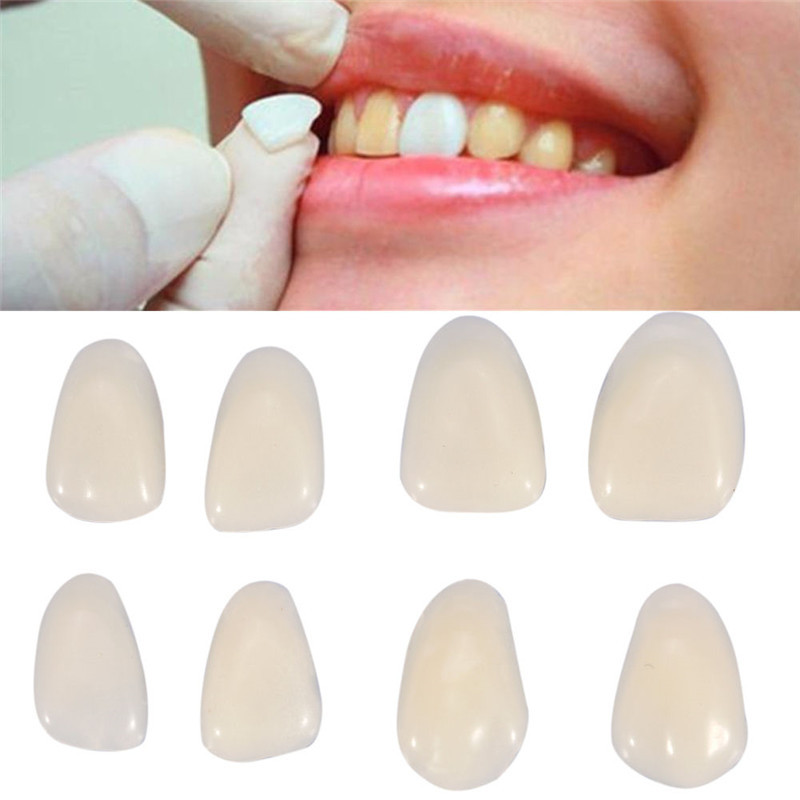 Teeth Whitening Uk - Tandheelkundige valse tanden Tijdelijke kroontanden Facings