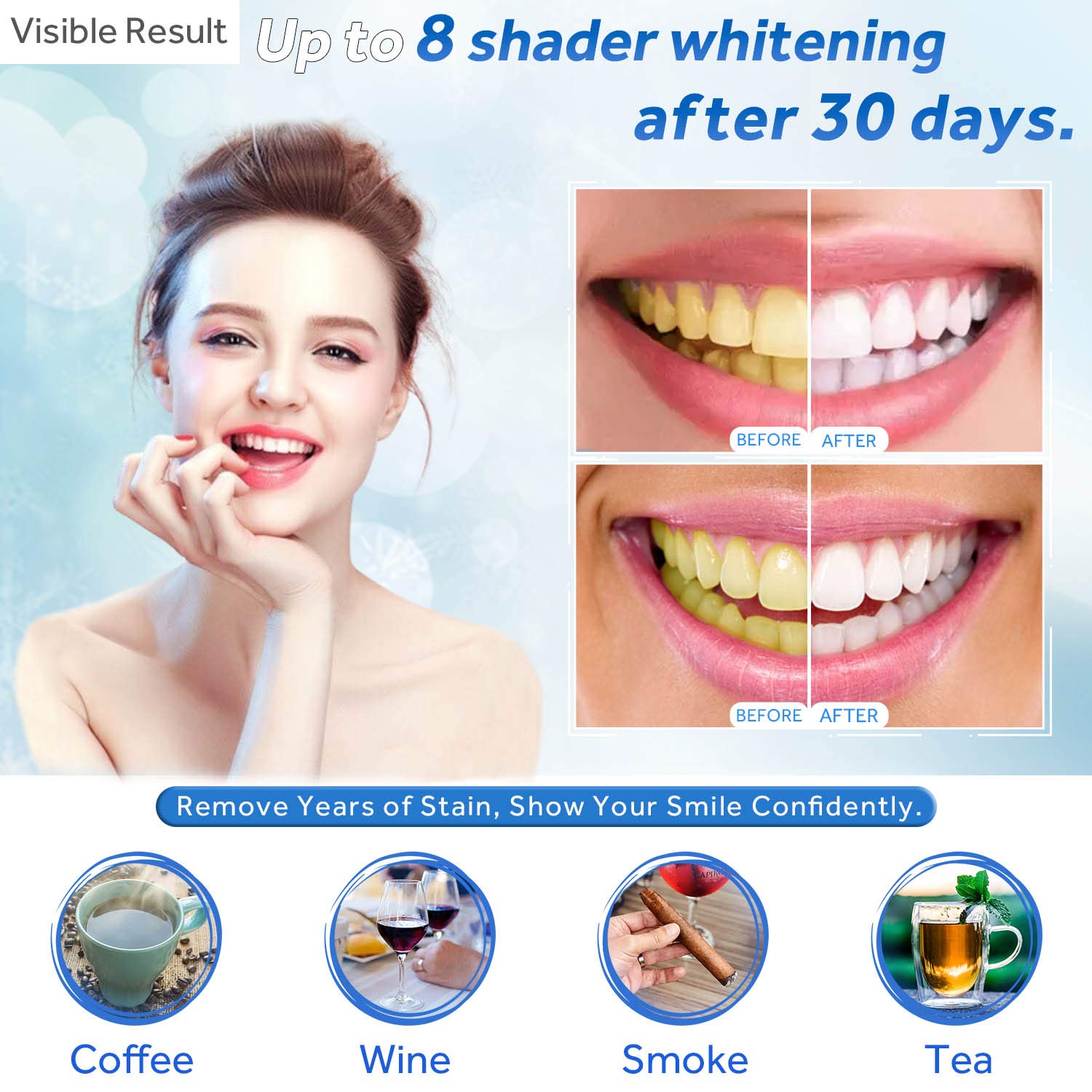 Tanden Whitening Gel Refill Sp - Teeth Whitening Gels Used By Dentists recensie en prijs