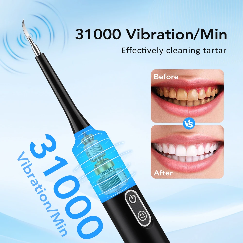 Elektrische sonische vibratie  - Teeth Whitening Uk recensie en prijs